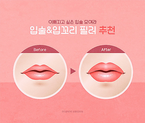 분홍색 일러스트 신체부위 뷰티 입 성형수술 입술 교정 시술 필러 국내일러스트 AI파일 컬러 사람 수술 파일형식 벡터