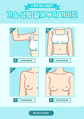 여자 하늘색 일러스트 신체부위 뷰티 가슴 부위 시술 가슴성형 가슴수술 방법 절개 매뉴얼 국내일러스트 AI파일 사람 파란색 수술 성형수술 파일형식 벡터