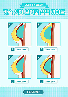 하늘색 일러스트 신체부위 뷰티 가슴 시술 가슴성형 가슴수술 삽입 보형물 국내일러스트 AI파일 사람 파란색 수술 성형수술 파일형식 벡터