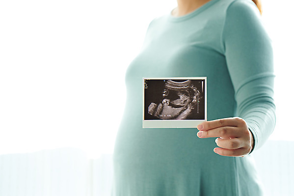 포토 JPG 스튜디오촬영 여자 가족 엄마 실내 건강 한명 서기 들기 상반신 옆모습 30대 부모 임산부 임신 한국인 흰색 창가 태교 태아 초음파사진 국내포토 1 뷰포인트 컬러 창문 관계 모션 사람 동양인 내부 장년 파일형식