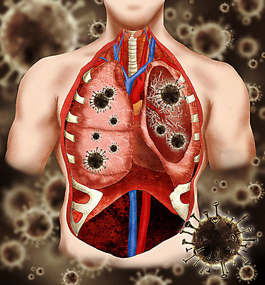 PSD 남자 신체 일러스트 해부 한명 허파 바이러스 질병 가슴 사회이슈 감염 폐렴 바이러스침투 인플루엔자 남자한명만 코로나바이러스 국내일러스트 1 컨셉 의학 사람 신체부위 호흡기관 남자만 파일형식