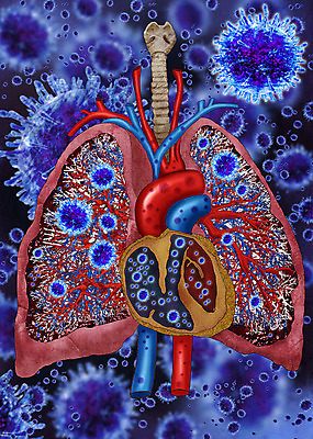 PSD 일러스트 해부 사람없음 허파 바이러스 질병 사회이슈 감염 인플루엔자 사스 국내일러스트 컨셉 의학 호흡기관 파일형식