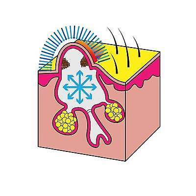 EPS 해외이미지 얼굴 과학 일러스트 해부 표면 세포 건강 종류 사람 치료 약 흰색 조직 질병 피부 생물학 감염 문제 층 박테리아 돌봄 막 해외일러스트 교육 컬러 의학 모션 신체부위 파일형식 벡터 이미지허브