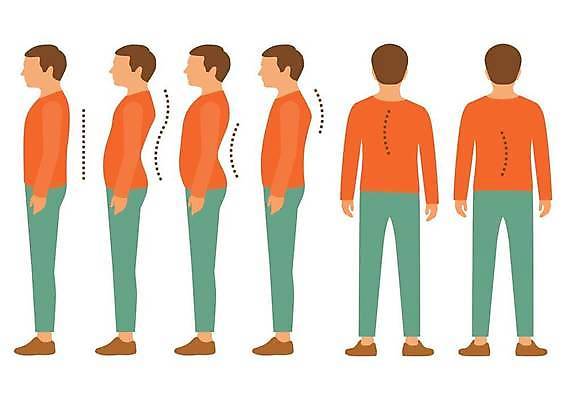 EPS 해외이미지 라이프스타일 과학 포즈 곡선 신체 일러스트 해부 뼈 건강 서기 사람 숫자 인포그래픽 고통 최고 만화 척추 위치 나쁜 돌봄 잘못 해외일러스트 문자 감정 선 의학 모션 생활 파일형식 벡터 이미지허브