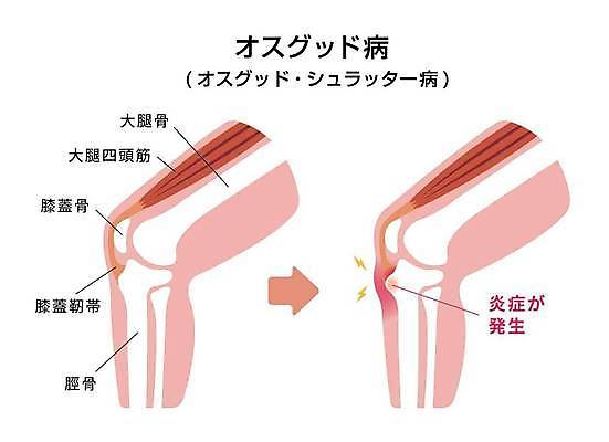 EPS 해외이미지 스포츠 과학 신체 일러스트 해부 근육 뼈 골격 건강 사람 고통 오르간 질병 상처 생물학 무릎 테라피 골절 돌봄 연골 해외일러스트 교육 감정 의학 모션 신체부위 뷰티 건반악기 파일형식 벡터 이미지허브