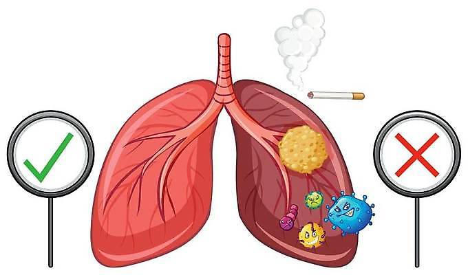 EPS 해외이미지 일러스트 흡연 담배 사람없음 건강관리 손상 팻말 허파 바이러스 X 체크표시 금연 담배연기 암 흡연금지 해외일러스트 알파벳 캠페인 컨셉 프레임 건강 관리 금지 호흡기관 연기 질병 사회이슈 확인 파일형식 벡터 이미지허브
