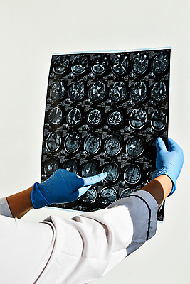 포토 JPG 해외이미지 직업 손 과학 해부 엑스레이 건강 병원 실험 사람 사람없음 치료 약 머리 시험 환자 의사 잡기 실험실 질병 뇌 암 테라피 방사선 스캐너 스캔 해외포토 교육 의학 모션 신체부위 뷰티 의료진 파일형식 이미지허브