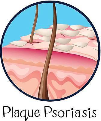 EPS 해외이미지 클립아트 손 백그라운드 일러스트 손가락 해부 건조 건강 미술 그래픽 약 질병 피부 그림 클립 감염 암 돌봄 면역력 명패 해외일러스트 의학 모션 문화예술 신체부위 파일형식 벡터 이미지허브