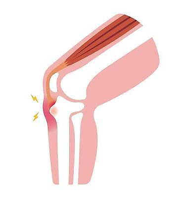 EPS 해외이미지 스포츠 과학 신체 일러스트 해부 근육 뼈 골격 건강 사람 고통 오르간 질병 상처 생물학 무릎 테라피 골절 돌봄 연골 해외일러스트 교육 감정 의학 모션 신체부위 뷰티 건반악기 파일형식 벡터 이미지허브