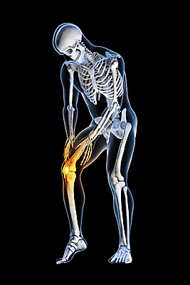 포토 JPG 해외이미지 남자 스포츠 과학 신체 일러스트 해부 뼈 골격 건강 사람 사람없음 그래픽 운동 약 3D 고통 의사 마사지 질병 상처 사건 관절염 근육질 무릎 외과 테라피 달리기선수 부담 염증 치유 해외포토 감정 의학 근육 병원 신체부위 뷰티 의료진 몸매 디지털합성 육상선수 파일형식 이미지허브