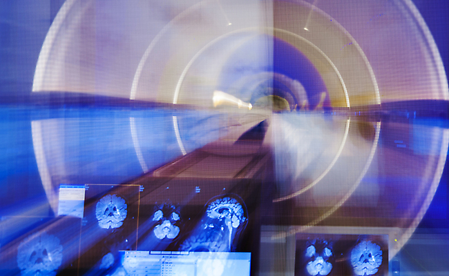 포토 JPG 해외이미지 과학 엑스레이 건강 병원 사람없음 컴퓨터 약 머리 기계 장비 공구 표현 실험실 뇌 전자 암 방사능 방사선 블러 스캐너 해외포토 의학 실험 신체부위 전자제품 도구 질병 파일형식 이미지허브