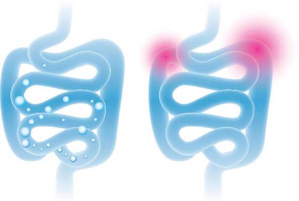 EPS 해외이미지 디자인 실루엣 신체 일러스트 해부 추상 엑스레이 건강 사람 그래픽 파란색 빛 거품 고통 오르간 질병 상처 작음 큼 가스 시스템 면역력 복근 영양소 해외일러스트 감정 컬러 무늬 의학 근육 촬영기법 건반악기 크기 파일형식 벡터 이미지허브