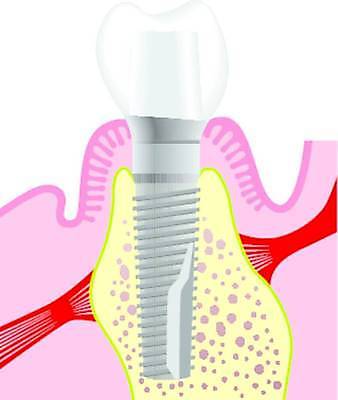 EPS 해외이미지 과학 일러스트 건강 병원 약 화장품 장비 도구 입 치아 치과의사 외과 턱 돌봄 위생관리 철강 치아교정 해외일러스트 의학 모션 관리 신체부위 뷰티 의사 소화기관 교정 파일형식 벡터 이미지허브