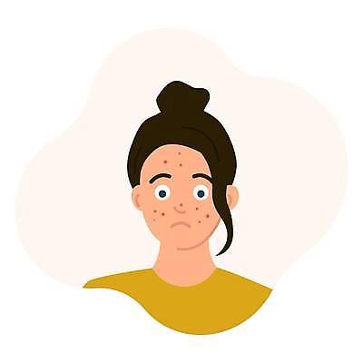 EPS 해외이미지 캐릭터 여자 얼굴 백그라운드 신체 일러스트 건강 사람 치료 10대 흰색 표현 만화 피부 피부관리 감염 문제 알레르기 나쁜 고립 돌봄 부담 트러블 못생김 해외일러스트 일러캐릭터 컬러 의학 모션 청소년 신체부위 뷰티 질병 파일형식 벡터 이미지허브