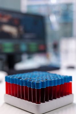 포토 JPG 해외이미지 실내 실험기구 실험 상반신 아웃포커스 견본 실험복 혈액 연구실 실험실 과학자 시험관 연구소 방호복 해외포토 직업 옷 과학 촬영기법 내부 가운 학자 파일형식 이미지허브