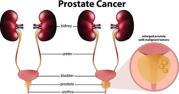 EPS 해외이미지 클립아트 교육 남자 백그라운드 신체 일러스트 부분 해부 건강 미술 그래픽 신장 질병 그림 클립 암 방광 해외일러스트 의학 문화예술 사람 비뇨기관 파일형식 벡터 이미지허브