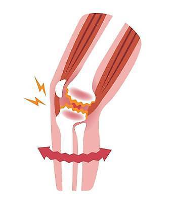 EPS 해외이미지 화살표 일러스트 의학 근육 뼈 건강 사람없음 질병 관절염 관절 무릎 무릎통증 해외일러스트 신체부위 고통 파일형식 벡터 이미지허브