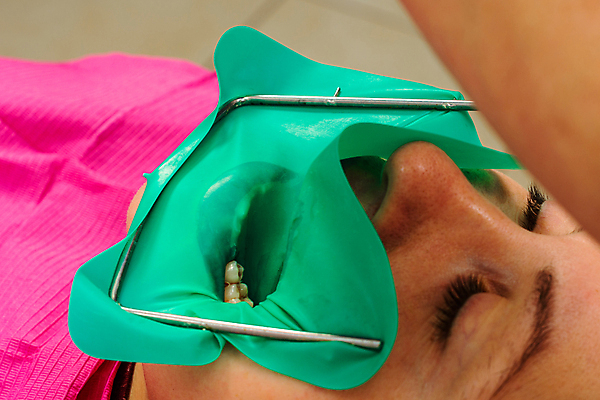 포토 JPG 해외이미지 백인 직업 손 장갑 부분 프레임 치과 병원 한명 사람 치료 약 장비 환자 의사 기구 도구 공구 업무 오픈 입 수술 치아 치과의사 시트 외과 순서 고립 돌봄 라텍스 위생관리 치통 해외포토 서양인 1 잡화 의학 모션 관리 신체부위 의료진 작업 소화기관 질병 파일형식 이미지허브