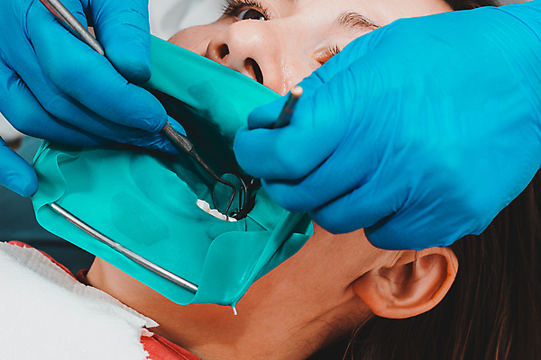 포토 JPG 해외이미지 직업 여자 장갑 프레임 건강 치과 병원 사람없음 치료 약 거울 장비 시험 환자 의사 기구 공구 입 수술 치아 질병 댐 연습 부식 치과의사 예방 시트 고무 외과 순서 돌봄 라텍스 위생관리 치통 해외포토 잡화 공공시설 교육 의학 모션 관리 사람 신체부위 의료진 도구 소화기관 파일형식 이미지허브