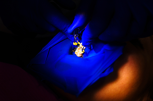 포토 JPG 해외이미지 직업 얼굴 장갑 건강 치과 병원 관리 한명 사람 치료 장비 환자 도구 공구 대접 업무 수술 환경오염 치아 댐 치과의사 방문 시트 고무 외과 순서 돌봄 위생관리 치통 실종 해외포토 1 잡화 공공시설 컨셉 의학 모션 신체부위 의사 작업 소화기관 질병 사건 파일형식 이미지허브