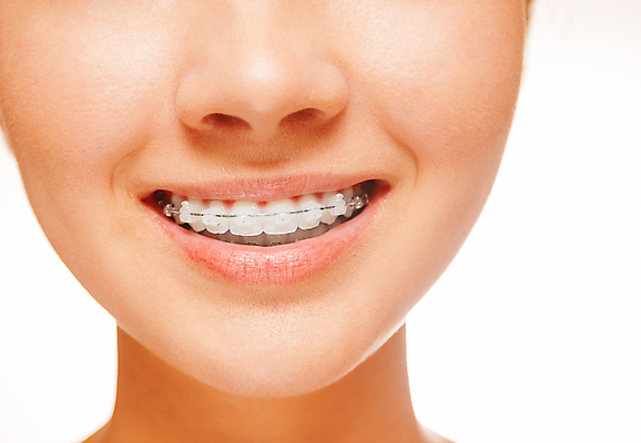 포토 JPG 해외이미지 백인 여자 행복 얼굴 건강 미소 사람 성인 사람없음 10대 장비 흰색 입 치아 순수 입술 위생관리 해외포토 서양인 감정 컬러 컨셉 청소년 표정 관리 신체부위 소화기관 파일형식 이미지허브