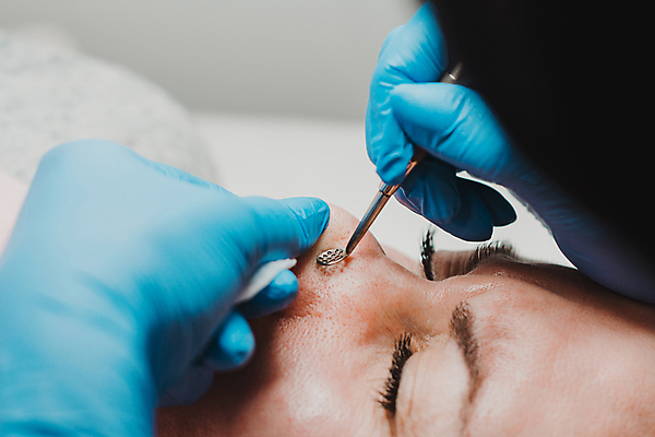 포토 JPG 해외이미지 직업 손 얼굴 장갑 건강 병원 한명 치료 약 건강관리 상점 스파 기계 화장품 고통 환자 의사 얼룩 미용사 청소 고객 피부 테라피 여드름 순서 돌봄 방법 치료사 치유 현재 해외포토 1 잡화 감정 컨셉 의학 모션 관리 사람 신체부위 뷰티 의료진 파일형식 이미지허브