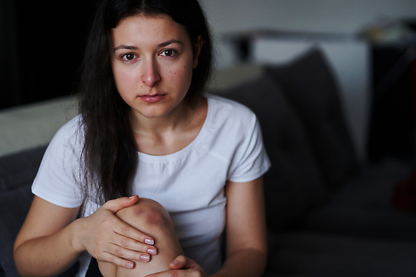 포토 JPG 해외이미지 응시 여자 한명 상반신 성인 앞모습 아웃포커스 고통 잡기 상처 울음 무릎 찰과상 성인여자한명만 해외포토 1 시선 감정 뷰포인트 모션 촬영기법 표정 사람 신체부위 여자한명만 성인여자만 파일형식 이미지허브