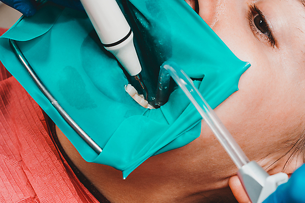 포토 JPG 해외이미지 장갑 프레임 건강 치과 병원 집게 한명 치료 물 사무실 약 거울 장비 환자 의사 기구 입 치아 질병 무서움 캐비닛 부식 치과의사 합성 뿌리 시트 고무 순서 돌봄 라텍스 위생관리 해외포토 자연요소 1 잡화 감정 비즈니스 의학 모션 관리 사람 신체부위 의료진 소화기관 사물함 파일형식 이미지허브