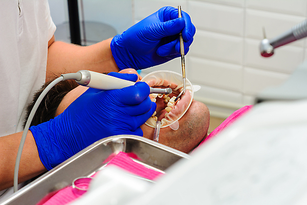 포토 JPG 해외이미지 직업 건강 치과 한명 사람 치료 뷰티 약 노란색 건강관리 기계 쌍안경 장비 환자 의사 기구 공구 입 치아 질병 청소 치과의사 순서 삭제 돌봄 위생관리 치통 해외포토 1 컬러 의학 모션 병원 관리 신체부위 망원경 의료진 도구 소화기관 파일형식 이미지허브