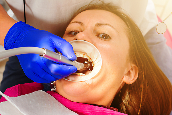 포토 JPG 해외이미지 직업 여자 안경 장갑 건강 치과 병원 한명 미소 옆모습 치료 물 사무실 약 쌍안경 장비 환자 의사 공구 치아 부식 치과의사 테라피 돌봄 송곳 위생관리 치통 살균 해외포토 자연요소 1 잡화 뷰포인트 비즈니스 의학 모션 표정 관리 사람 뷰티 망원경 의료진 도구 소화기관 질병 파일형식 이미지허브