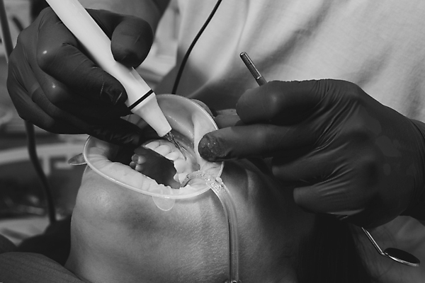 포토 JPG 해외이미지 장갑 흑백 건강 치과 병원 한명 성인 치료 뷰티 약 장비 시험 환자 의사 공구 입 구멍 치아 부식 치과의사 외과 순서 돌봄 염증 위생관리 치통 해외포토 1 잡화 교육 의학 모션 촬영기법 관리 사람 신체부위 의료진 도구 소화기관 질병 파일형식 이미지허브