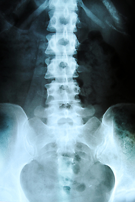 포토 JPG 해외이미지 여자 교육 과학 신체 해부 뼈 골격 엑스레이 건강 병원 사람 성인 사람없음 약 시험 환자 의사 광선 기둥 디스크 질병 X 엉덩이 필름 척추 외과 돌봄 방사선 해외포토 알파벳 건축 의학 모션 신체부위 의료진 파일형식 이미지허브