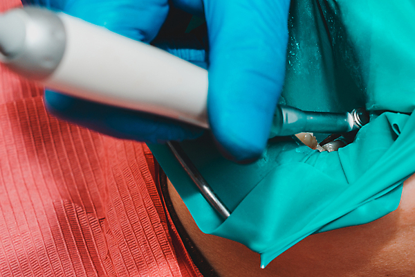 포토 JPG 해외이미지 직업 프레임 건강 치과 병원 집게 사람없음 치료 물 약 거울 고통 장비 환자 의사 기구 공구 입 치아 보호 무서움 댐 캐비닛 부식 치과의사 합성 제트기 시트 고무 순서 돌봄 라텍스 치아교정 출석 해외포토 자연요소 공공시설 감정 컨셉 의학 모션 비행기 신체부위 의료진 도구 소화기관 사물함 교정 파일형식 이미지허브