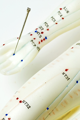 포토 JPG 해외이미지 모델 전통 아시아 백그라운드 컨셉 자연 건강 사람없음 치료 스터디 약 금속 중국 침묵 골동품 공구 바늘 가르침 작업실 닫기 오브젝트 테라피 내추럴 세미나 해외포토 교육 나라 의학 모션 재질 학습 뷰티 소리 도구 생태계 파일형식 이미지허브