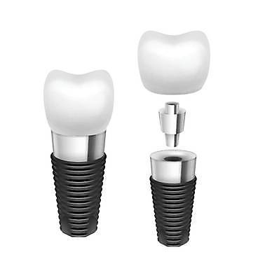 EPS 해외이미지 모델 1 백그라운드 일러스트 왕관 새로움 건강 병원 치료 약 금속 흰색 나사 도자기 입 수술 치아 오브젝트 싱글 치과의사 뿌리 고립 보철 인공 철강 해외일러스트 컬러 컨셉 의학 재질 신체부위 의사 공구 소화기관 파일형식 벡터 이미지허브