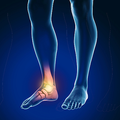 포토 JPG 해외이미지 남자 백그라운드 신체 일러스트 해부 뼈 골격 엑스레이 건강 사람 사람없음 파란색 3D 고통 시험 광선 X 생물학 골다공증 시스템 발가락 발목 고립 양발 정형외과 해외포토 알파벳 교육 감정 컬러 의학 발 병원 질병 디지털합성 파일형식 이미지허브