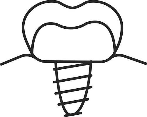 EPS 해외이미지 클립아트 디자인 선 컨셉 일러스트 왕관 건강 치과 병원 미술 치료 픽토그램 약 금속 웹 나사 입 구멍 플랫 치아 심볼 사인 그림 치과의사 윤곽 뿌리 외과 틀니 고립 돌봄 보철 얇은 인공 해외일러스트 인터넷 의학 모션 재질 문화예술 신체부위 의사 공구 소화기관 파일형식 벡터 이미지허브