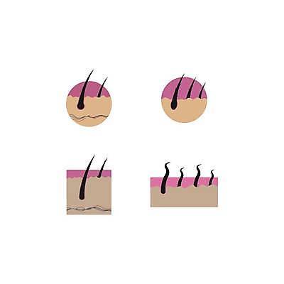 EPS 해외이미지 템플릿 과학 일러스트 전구 건조 세포 건강 사람 치료 약 머리 검은색 스파 손상 성장 감각 수리 보호 질병 강의 심볼 피부 그림 뿌리 대머리 샴푸 삭제 고립 돌봄 위생관리 적자 공급 해외일러스트 헤어스타일 컬러 컨셉 의학 모션 관리 신체부위 위생용품 파일형식 벡터 이미지허브