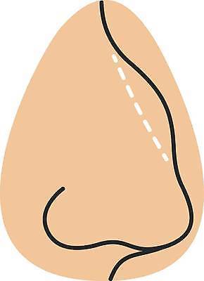 EPS 해외이미지 클립아트 모양 직업 디자인 여자 얼굴 신체 일러스트 병원 치료 뷰티 약 웹 화장품 환자 수술 플라스틱 만화 하락 가득함 심볼 피부 서비스 그림 코 윤곽 외과 혹 순서 삭제 고립 돌봄 복원 스타일 해외일러스트 컨셉 인터넷 의학 모션 재질 사람 신체부위 파일형식 벡터 이미지허브