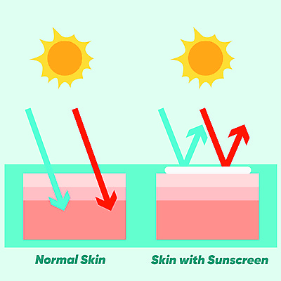 포토 JPG 해외이미지 신체 일러스트 사람없음 그래픽 여름 햇빛 태양 블록 손상 인포그래픽 광선 비교 플랫 보호 피부 크림 로션 스킨케어 층 보호자 자외선 화상 해외일러스트 자연요소 계절 컨셉 신체부위 뷰티 화장품 상처 파일형식 이미지허브