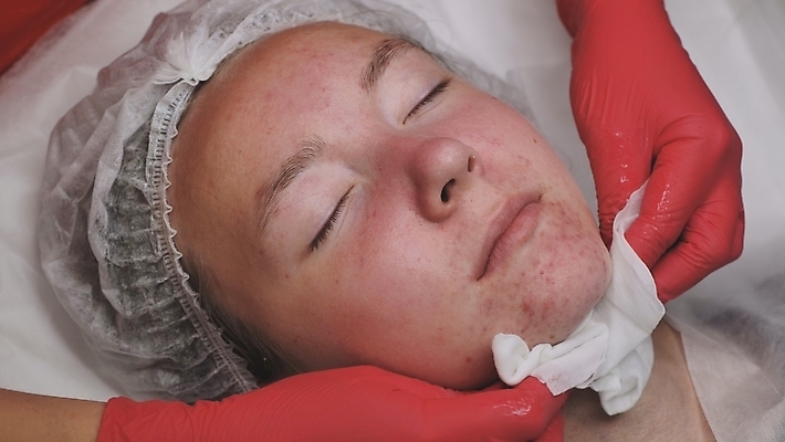 포토 JPG 해외이미지 여자 얼굴 신체 휴식 건강 가면 한명 사람 동양인 치료 초록색 뷰티 머리 상점 스파 화장품 껍질 흰색 해조류 고급 씻기 플라스틱 가루 미용사 고객 피부 피부관리 객실 점토 진흙 테라피 삭제 돌봄 얇은 조작 안락 해외포토 직업 1 컬러 컨셉 의학 모션 재질 인종 신체부위 청결 해양식물 파일형식 이미지허브