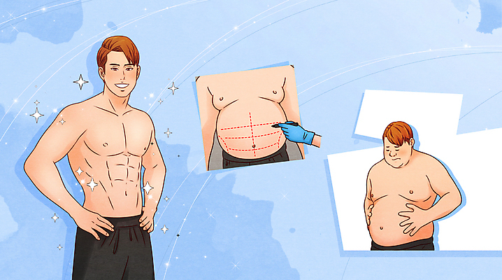 PSD 손 남자 점선 허리손 하늘색 일러스트 들기 상반신 성인 신체부위 세명 반짝임 뷰티 펜 잡기 그리기 변화 성형수술 몸매 비만 지방흡입 성인남자만 국내일러스트 선 포즈 컨셉 모션 사람 파란색 필기구 수술 남자만 성인만 파일형식