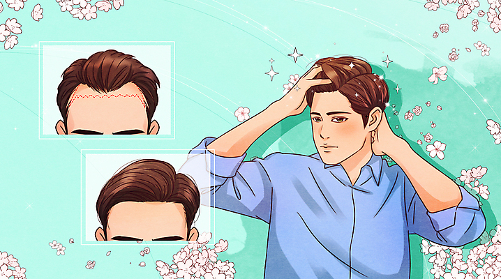 PSD 남자 꽃 일러스트 손짓 상반신 성인 세명 뷰티 머리카락 머리 손들기 비교 변화 모발이식 민트색 이마 탈모 성인남자만 국내일러스트 식물 컬러 컨셉 모션 사람 신체부위 증상 남자만 성인만 파일형식