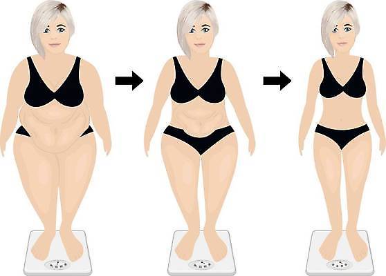 EPS 해외이미지 모양 라이프스타일 여자 다이어트 일러스트 건강 운동 숫자 무대 흰색 수술 결과 몸무게 큼 엉덩이 비만 날씬함 허리 피부 연습 몸통 외과 적자 해로움 해외일러스트 문자 컬러 컨셉 의학 병원 사람 생활 신체부위 치료 크기 몸매 파일형식 벡터 이미지허브