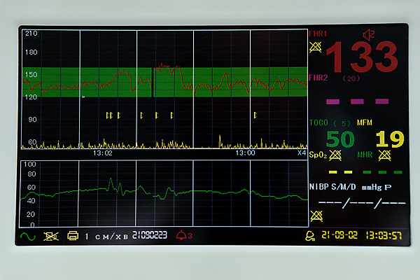 포토 JPG 해외이미지 백인 손 커플 여자 어린이 백그라운드 가족 엄마 건강 병원 사랑 한명 컴퓨터 사무실 3D 건강관리 모니터 스파 임신 시험 환자 의사 하트 아기 마사지 맥박 태교 돌봄 해외포토 모양 서양인 1 교육 감정 비즈니스 의학 관계 모션 관리 사람 신체부위 전자제품 의료진 디지털합성 파일형식 이미지허브