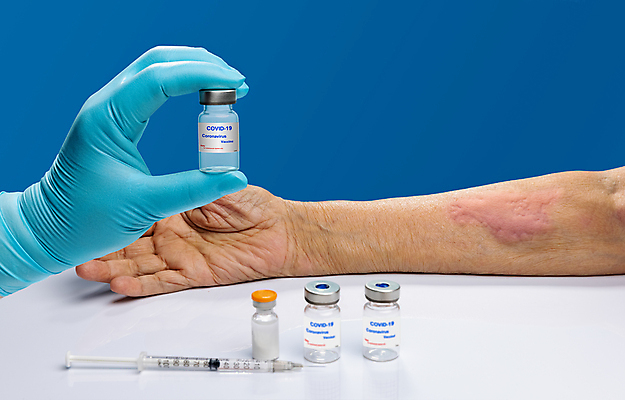 포토 JPG 해외이미지 태국 한국 건강 피곤 안전 사람 동양인 사람없음 약 건강관리 일본 중국 열 질병 인도인 피부 알레르기 돌봄 백신 예방접종 증상 효과 해외포토 외국인 아시아 컨셉 의학 모션 관리 인종 신체부위 접종 파일형식 이미지허브