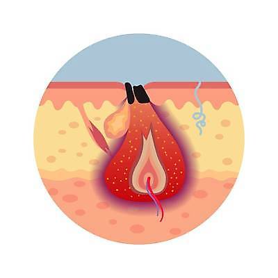 EPS 해외이미지 얼굴 일러스트 해부 유리 세포 건강 사람 치료 약 확대 질병 피부 감염 문제 박테리아 돌봄 해외일러스트 의학 모션 재질 신체부위 파일형식 벡터 이미지허브