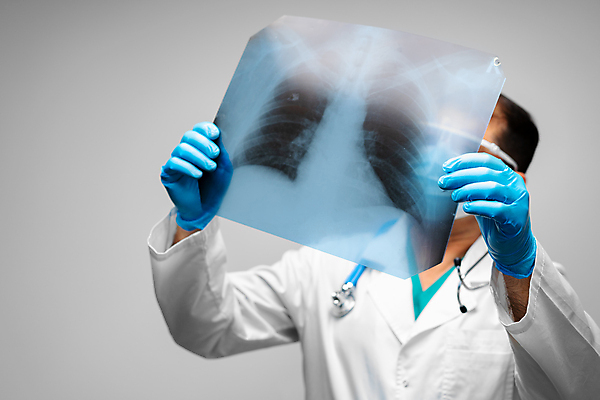 포토 JPG 해외이미지 남자 의학 회색배경 엑스레이 실내 한명 들기 상반신 성인 앞모습 옆모습 의사 확인 성인남자한명만 해외포토 1 뷰포인트 백그라운드 모션 사람 내부 회색 의료진 남자한명만 성인남자만 파일형식 이미지허브