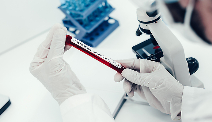 포토 JPG 해외이미지 손 의학 실내 현미경 들기 신체부위 소프트포커스 확인 시험관 코로나바이러스 델타변이바이러스 오미크론 해외포토 모션 촬영기법 실험기구 사람 내부 바이러스 파일형식 이미지허브