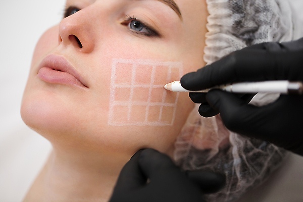 포토 JPG 해외이미지 백인 손 여자 얼굴 선 장갑 신체 건강 병원 사람 성인 두명 치료 파란색 뷰티 약 연필 화장품 환자 의사 흰색 주름 수술 플라스틱 미용사 피부 흔적 피부관리 그림 리프트 외과 테라피 순서 돌봄 리프팅 노화 해외포토 서양인 직업 잡화 컬러 컨셉 의학 모션 재질 학용품 신체부위 필기구 의료진 파일형식 이미지허브